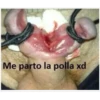 Peness 5